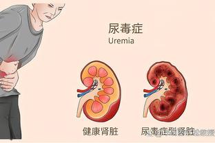 意天空预测欧冠首发：拉齐奥相比首回合仅换1人，拜仁防线大调整